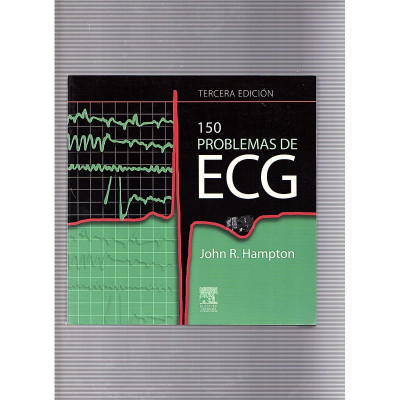 150 problemas de ECG / John R. Hampton