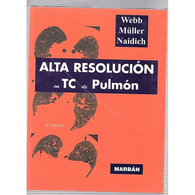 Alta resolución en TC de Pulmón  /  Webb, Müller y Naidich