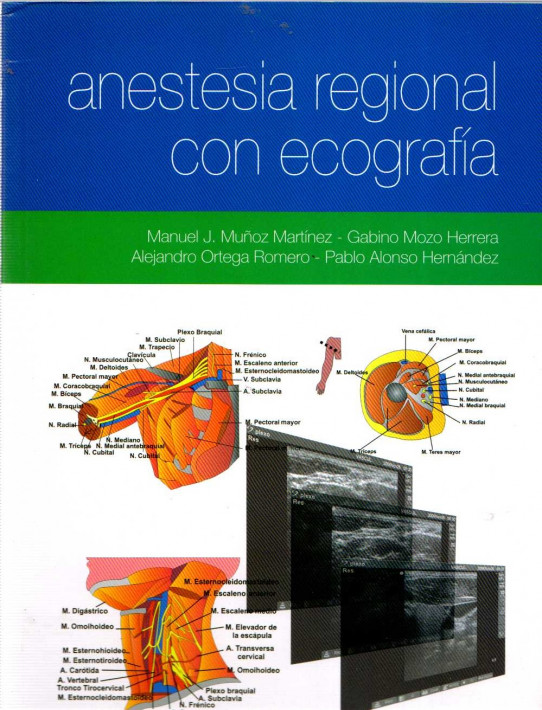 ANESTESIA REGIONAL CON ECOGRAFÍA