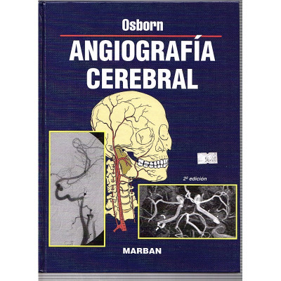 ANGRIOGRAFÍA CEREBRAL / Osborn