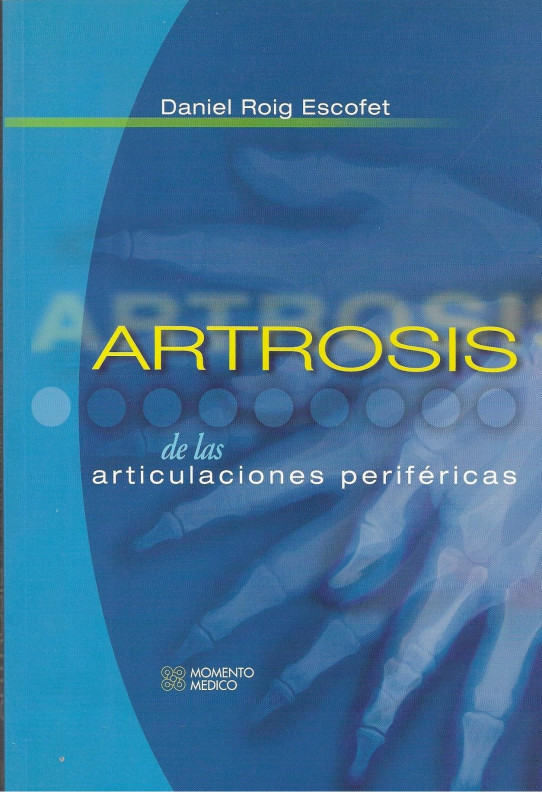 ARTROSISI DE LAS ARTICULACIONES PERIFÉRICAS