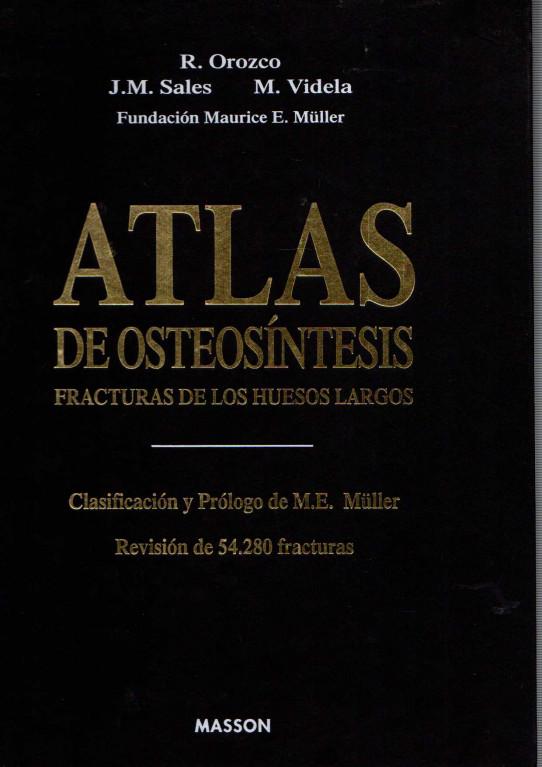 ATLAS DE OSTEOSÍNTESIS. FRACTURAS DE LOS HUESOS LARGOS