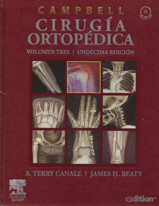 CAMPELL CIRUGÍA ORTOPÉDICA (4 VOLUMÉNES)