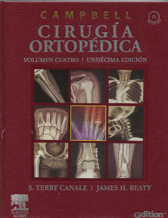 CAMPELL CIRUGÍA ORTOPÉDICA (4 VOLUMÉNES)