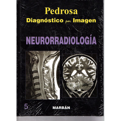 Diagnóstico por Imagen. NEURORRADIOLOGÍA / Pedrosa