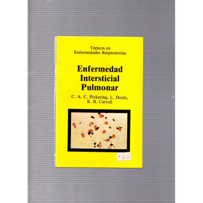 Enfermedad Intersticiaal Pulmonar / C. A. C. Pickering, L. Doyle y K. B. Carroll