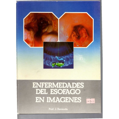 Enfermedades del esófago en imágenes / Prof. J. Ferrando
