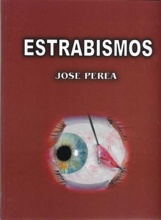 ESTRABISMOS.