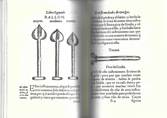 LIBRO SEGUNDO EN EL QUE SE TRATA DE TODAS LAS ENFERMEDADES DE LA VEXIGA