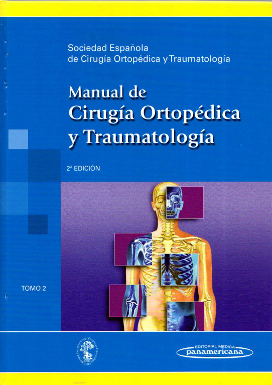 MANUAL DE CIRUGIA ORTOPÉDICA Y TRAUMATOLOGIA. Tomo 2 (de 2)