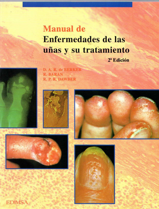 MANUAL DE ENFERMEDADES DE LAS UÑAS Y SU TRATAMIENTO