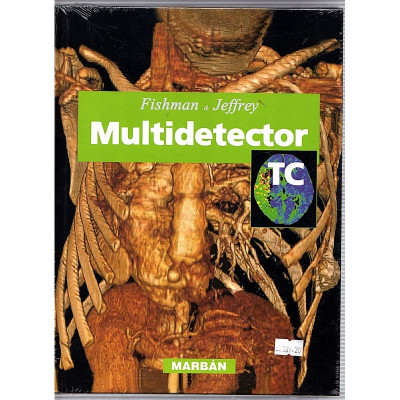 Multidetector / Fishman y Jeffrey