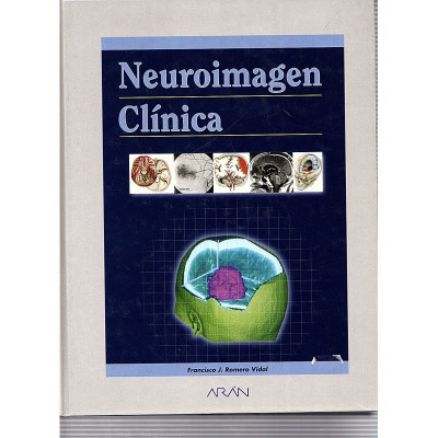 Neuroimagen Clínica / Francisco J. Romero