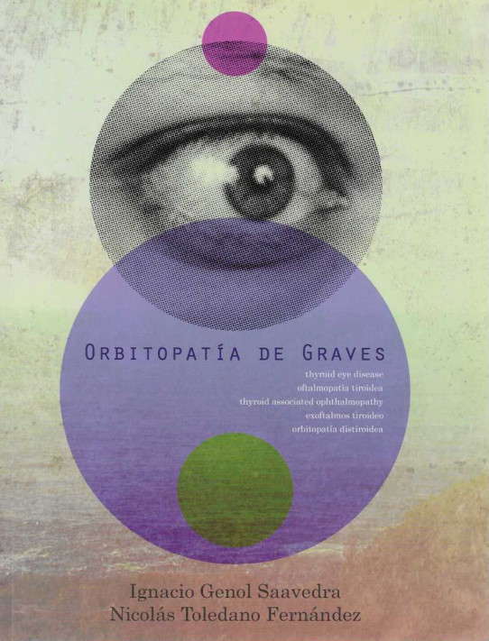 ORBITOLOGÍA DE GRAVES.