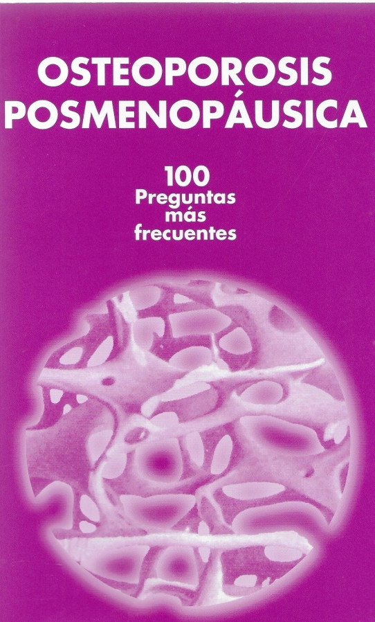 OSTEOPOROSISI POSMENOPÁUSICA. 100 PREGUNTAS MAS FRECUENTES