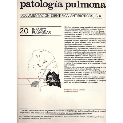 Patología pulmonar Documentación científica / Antibioticos S.A.