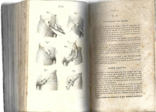 Précis Iconographique de MEDICINE OPERATOIRE ET D'ANATOMIE CHIRURGICALE