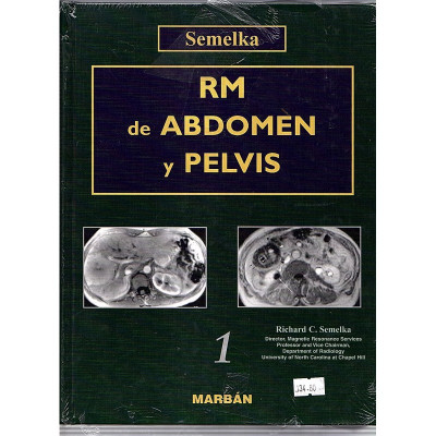 RM de Abdom y Pelvis (1 y 2 volums) / Semelka
