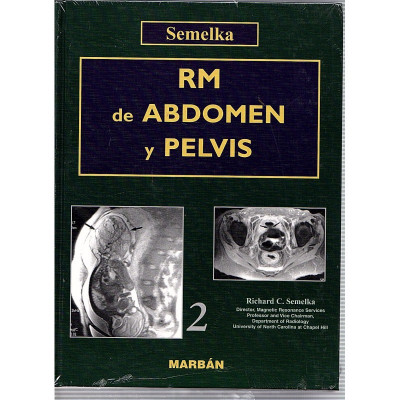 RM de Abdom y Pelvis (1 y 2 volums) / Semelka