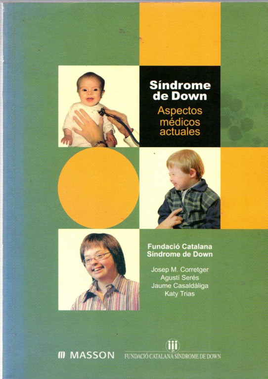 SÍNDROME DE DOWN