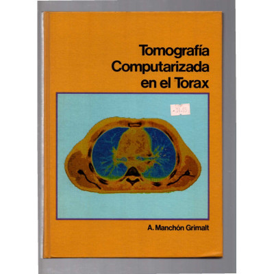 Tomografia Computarizada en el tórax / A. Manchón Grimalt