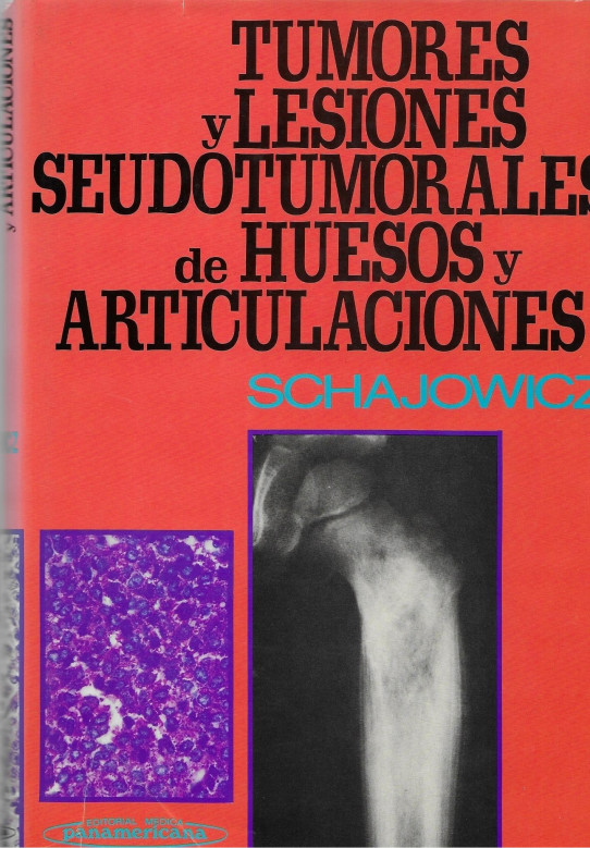 TUMORES Y LESIONES SEUDOTUMORALES DE HUESOS Y ARTICULACIONES