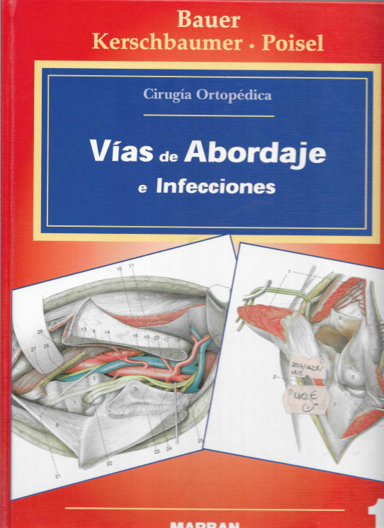 Vías de abordaje e Infecciones. Cirugía Ortopédica 1
